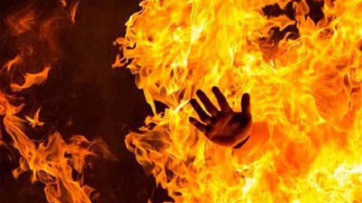 সন্তান না হওয়ার হতাশায় মা দিলেন গায়ে আগুন