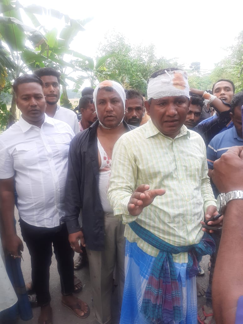 তুচ্ছ ঘটনাকে কেন্দ্র করে সাবেক ইউনিয়ন চেয়ারম্যান কুপিয়ে আহত